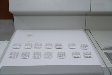 Paraffin blocks containing biopsy tissue for sectioning on a cold plate. Pathology laboratory....