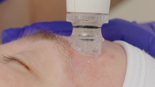 skin cleaning vacuum. Beauty treatment health centre. Skin cleaning machine.
