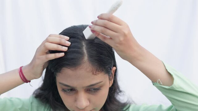 microneedling treatment for androgenic alopecia, a young lady using derma stamp on alopecia head to stimulate hair follicle.
