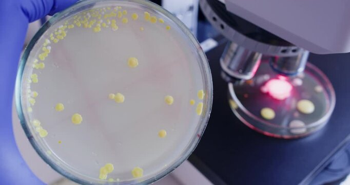 Microscope examination of bacteria in a laboratory. Yellow colonies of bacteria on a nutrient medium.