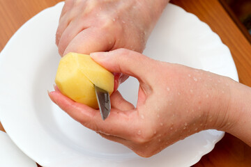 Peeling a potato with care in a cozy kitchen setting