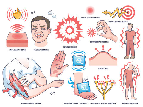 Acute pain worksheet concept shows a person grimacing, inflamed tissue, and pain signals to illustrate pain response. Outline style collection