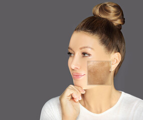 Dark spots, freckles,hyperpigmentation(melasma or chloasma),concept- skin lightening, skin whitening, Skin Brightening	