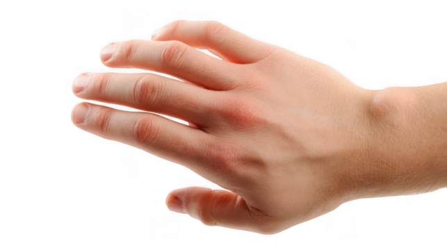 Caucasian male hand demonstrating swollen joints, a common symptom of arthritis, against a transparent background, suitable for compositing and medical illustrations - Powered by Adobe