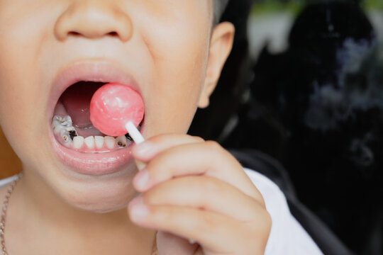 This boy lost his teeth from eating sweets and nibbles, which is likely due to natural loss. His smile reveals gaps where teeth used to be, giving him an attractive, young, and cheerful appearance.