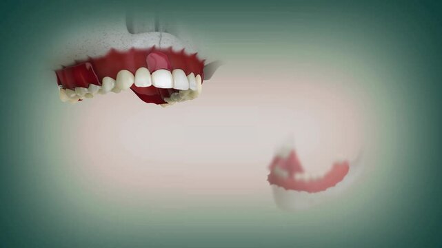 Partial Denture (Two materials-metallic and non-metallic) for the both upper and lower jaw.Medically accurate amazing 3D dental animation.
                 