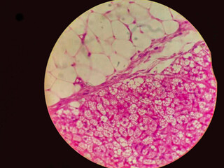 Micrograph of human tissue