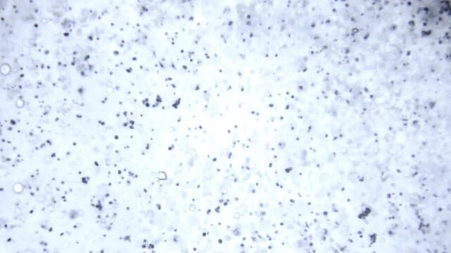 Microscopic View of Suspended Particles in a Fluid Medium