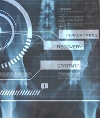Medical interface on xray