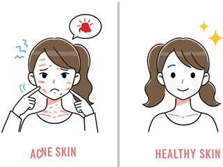 Skin Care Transformation Illustration: Before and After Showing Acne to Healthy Skin