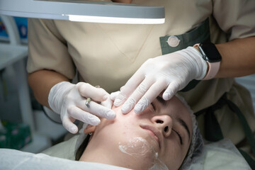 Microneedling Facial Treatment Clinic Skincare Procedure: Professional performs cosmetic needling...