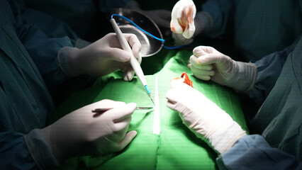 Doctors Performing Operation Inside Hospital Surgery Room Close Up with Cinematic Lighting Landscape View