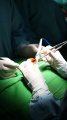 Doctors Conducting Operation in Hospital Surgery Room Close Up View of Surgeon Hands in Cinematic Light