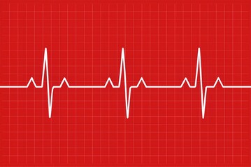 Accurate digital cardiogram trace on red grid background featuring white heartbeat lines, representing health data analysis and professional medical diagnostics