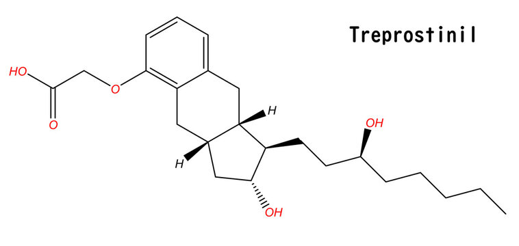 Treprostinil is a manufactured prostacyclin, a naturally occurring substance in the body that affects dilating blood vessels