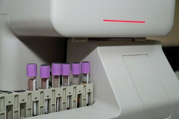 blood for examination in the hematology analyzer, Close-up view focused on the tubes