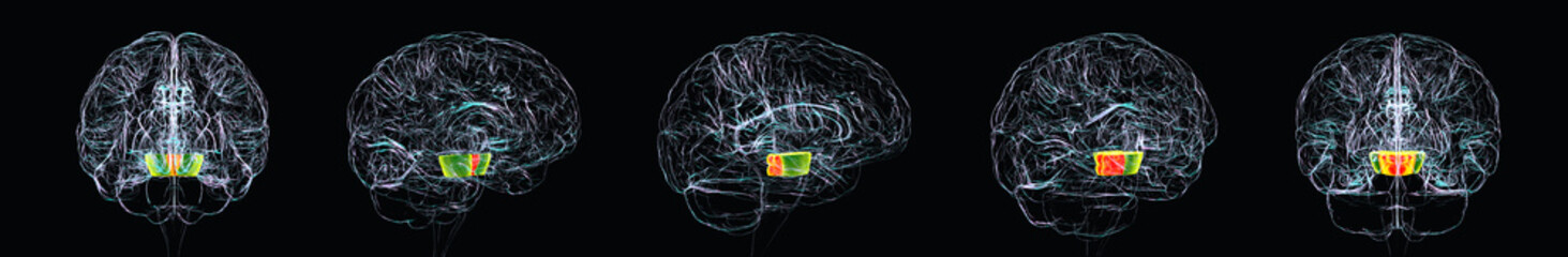 Human brain with the midbrain highlighted, 3D illustration