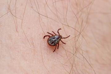 a tick crawls mite on a person's arm, close-up, macro