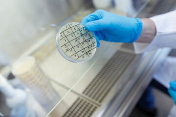 scientist working in laboratory on microbes