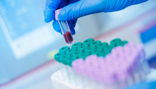 Veterinary lab testing: blood sample in clinical analysis with gloved hand