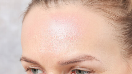 Oily forehead closeup showing shiny skin texture with visible pores and natural complexion on light skinned person in detailed macro shot