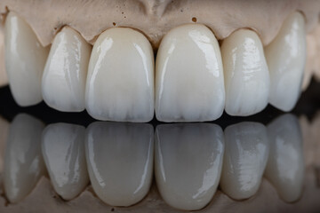 Dental health care. Ceramic zirconium in final version. Close up dental zircon ceramic crowns on black background