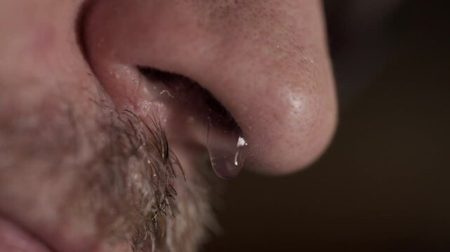 A liquid snot running out of a nose 