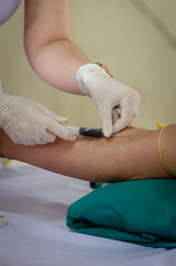 Soft focus on the hands of the doctor drawing a blood sample from the arm for blood test finds in hospital.