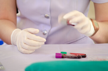 Blurred motion of nurse hand wearing white medical gloves shaking blood vessel for examining or performing PRP procedure. Concept of laboratory research, medicine, analysis.