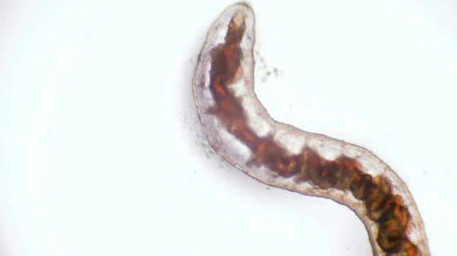 Microscopic View of a Nematode Worm Under a Microscope