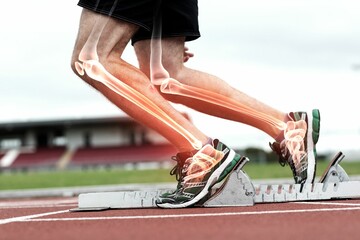 Runner experiencing leg pain