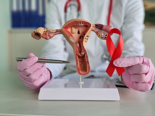 Symptoms of HIV in women. Cervical dysplasia in women with HIV. The concept of protecting women health from AIDS concept