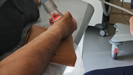 Hand undergoing laser therapy treatment in a medical clinic