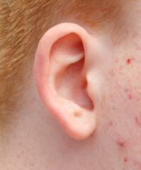 A close up of a person's ear with a red head