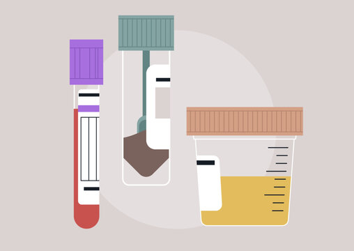 Three distinct lab test samples depict different collection methods, Color-coded tubes and containers showcase the variety of substances required for accurate medical testing in a clinical environment