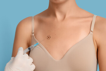 Dermatologist taking puncture from young woman's mole on blue background, closeup