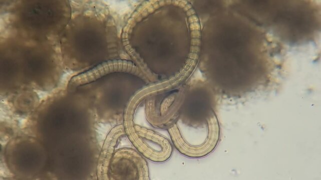 Parasites in feces.