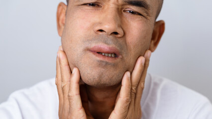 Man has facial swelling due to an allergic reaction to triggers such as insect bites, food