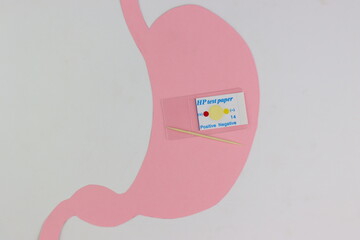 helicobacter pylori Test. Fast test to detect a stomach bacteria called helicobacter pylori