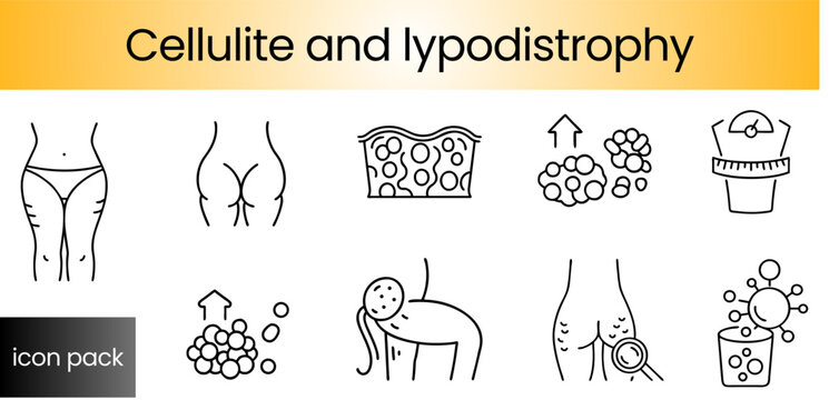 Cellulite and lipodystrophy icon set: treatment and affected areas