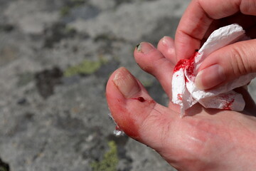 Small foot injury. Bloody paper. Close up and isolated.