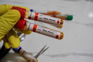 PSA total - Test and PSA free test with blood sample. Top view isolated on office desk. Healthcare or Medical concept