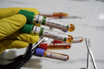 AST SGOT - Test and ALT SGOT Test with blood sample. Top view isolated on office desk. Healthcare...