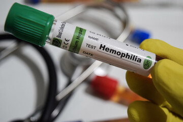 Hemophilia - Test with blood sample. Top view isolated on office desk. Healthcare or Medical concept