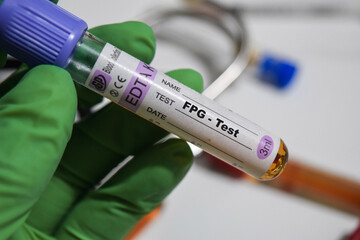 FPG - Test with blood sample. Top view isolated on office desk. Healthcare or Medical concept