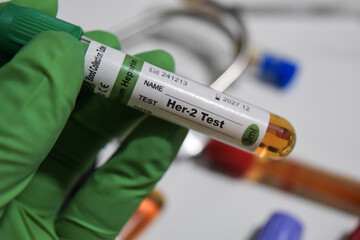 Her-2 - Test with blood sample. Top view isolated on office desk. Healthcare or Medical concept