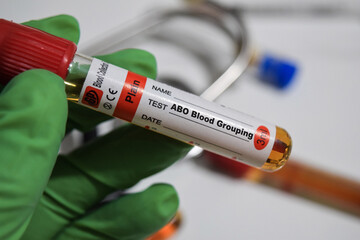 ABO Blood Grouping - Test with blood sample. Top view isolated on office desk. Healthcare or Medical concept
