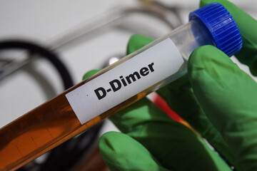 D-Dimer - Test with blood sample. Top view isolated on office desk. Healthcare or Medical concept
