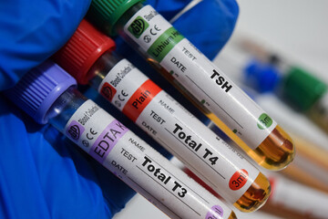 TSH - Test, Total T4 Test, and Total T3 Test with blood sample. Top view isolated on office desk....