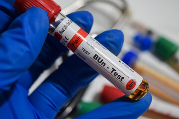 BUn - Test with blood sample. Top view isolated on office desk. Healthcare or Medical concept